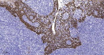 NMDAε2 rabbit pAb Antibody