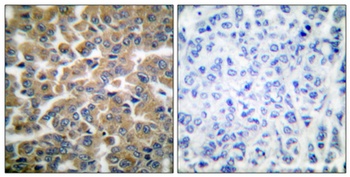 GR rabbit pAb Antibody