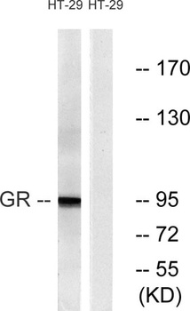 GR rabbit pAb Antibody