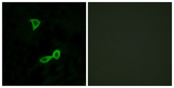 mGluR2 rabbit pAb Antibody