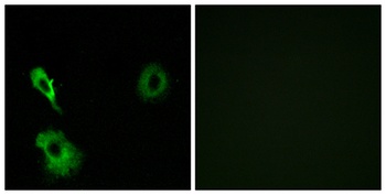 mGluR7 rabbit pAb Antibody