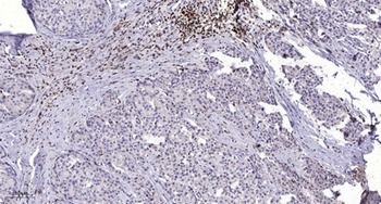 mGluR7 rabbit pAb Antibody