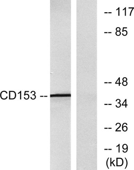 CD30-L rabbit pAb Antibody