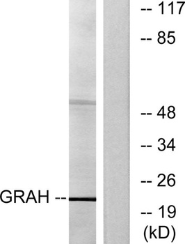 Granzyme H rabbit pAb Antibody