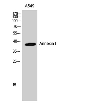 Annexin I rabbit pAb Antibody