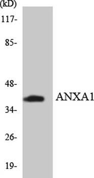 Annexin I rabbit pAb Antibody