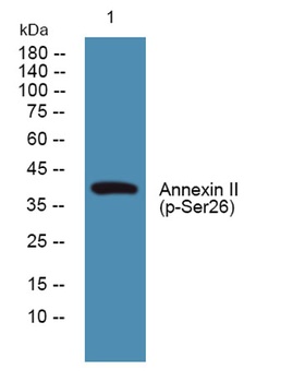 Annexin II (phospho Ser26) rabbit pAb Antibody