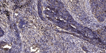 Lck BP-1 (phospho Tyr378) rabbit pAb Antibody