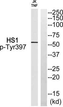 Lck BP-1 (phospho Tyr397) rabbit pAb Antibody