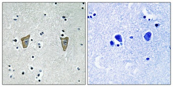 DREAM (phospho Ser63) rabbit pAb