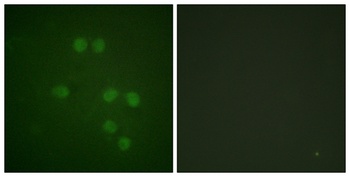 HMG-14 rabbit pAb Antibody