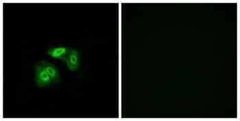 V1RL5 rabbit pAb Antibody
