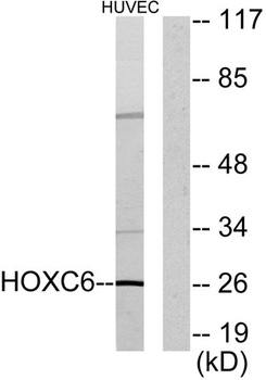 Hox-C6 rabbit pAb Antibody