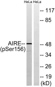 AIRE-1 (phospho Ser156) rabbit pAb Antibody