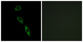 E-Ras rabbit pAb Antibody