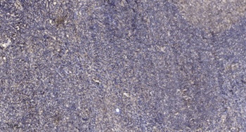 HSF2 rabbit pAb Antibody