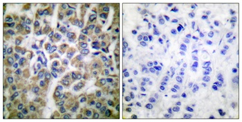 HSP10 rabbit pAb Antibody