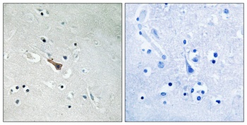 APLP2 (phospho Tyr755) rabbit pAb Antibody