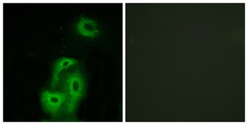 SR-2A rabbit pAb Antibody