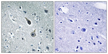 SR-2A rabbit pAb Antibody