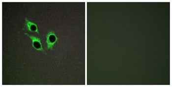 Anoctamin-9 rabbit pAb Antibody