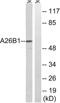 POTE15 rabbit pAb Antibody