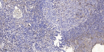 POTE15 rabbit pAb Antibody