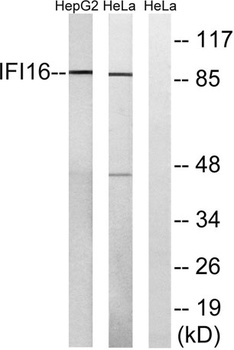 IFI-16 rabbit pAb Antibody
