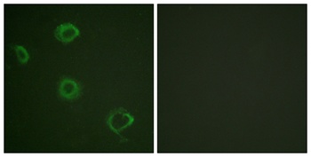 IFN-γRα (phospho Tyr457) rabbit pAb