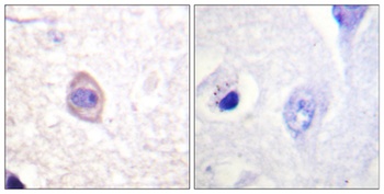 IFN-γRα (phospho Tyr457) rabbit pAb
