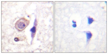 IFN-γRα rabbit pAb