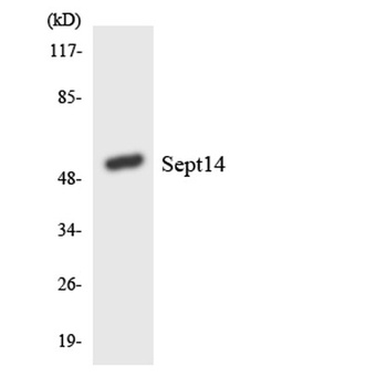 Septin 14 rabbit pAb Antibody