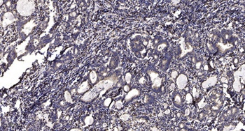 Septin 14 rabbit pAb Antibody