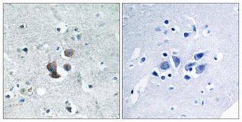 IGFBP7 rabbit pAb Antibody