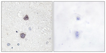 AQP2 (phospho Ser256) rabbit pAb Antibody
