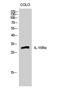 IL-15Rα rabbit pAb Antibody
