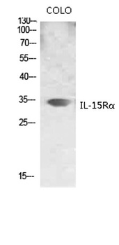IL-15Rα rabbit pAb Antibody