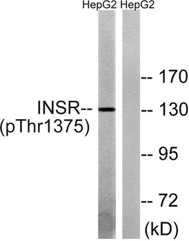 Insulin R (phospho Thr1375) rabbit pAb