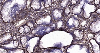 Insulin R (phospho Thr1375) rabbit pAb