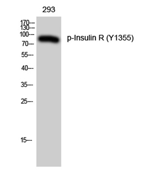Insulin R (phospho Tyr1355) rabbit pAb