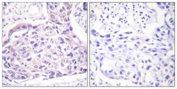 IRS-1 (phospho Ser323) rabbit pAb