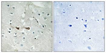 Integrin α4 (phospho Ser1027) rabbit pAb Antibody