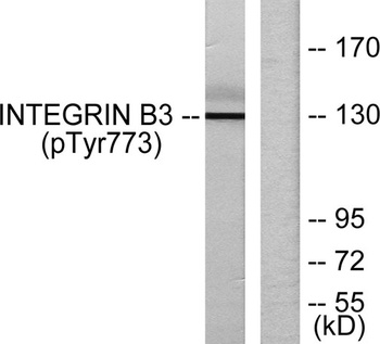 Integrin β3 (phospho Tyr773) rabbit pAb