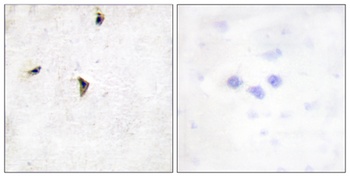 Kv2.1 rabbit pAb Antibody