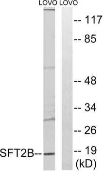 SFT2D2 rabbit pAb Antibody