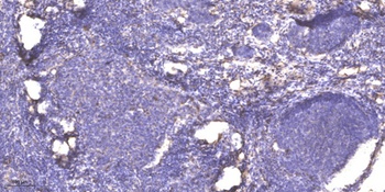 SFT2D2 rabbit pAb Antibody
