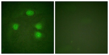 KIR3.1 rabbit pAb Antibody