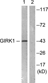 KIR3.1 rabbit pAb Antibody