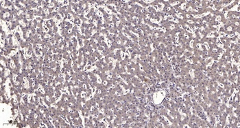 KIR3.1 rabbit pAb Antibody