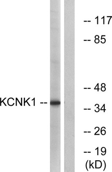 TWIK-1 rabbit pAb Antibody